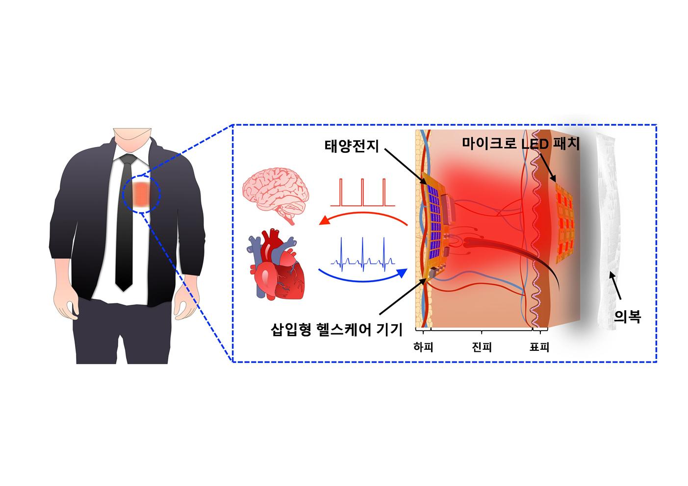 본문이미지